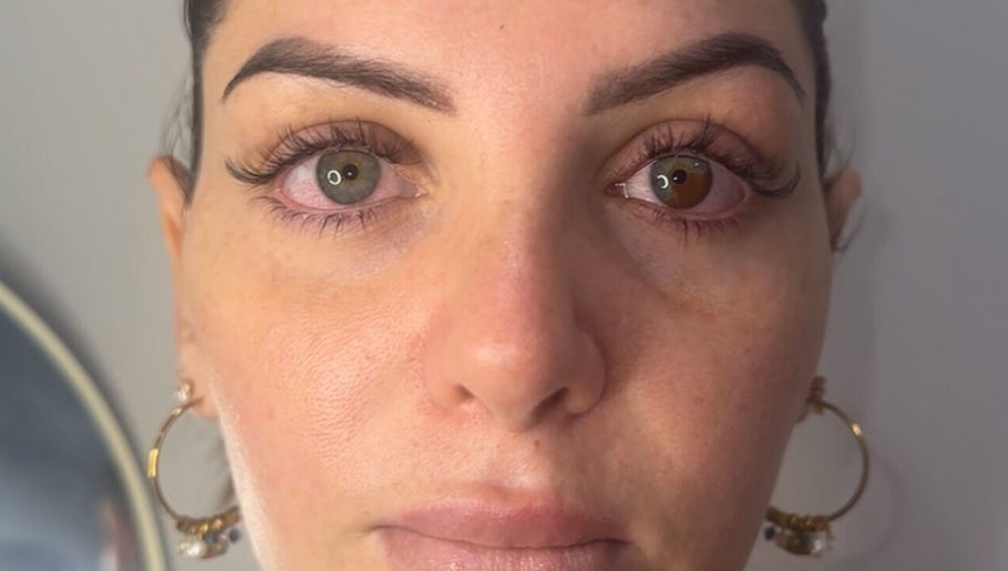 Woman's refreshed eyes after treatment at Wellness Spa, Montréal, Québec, CA.