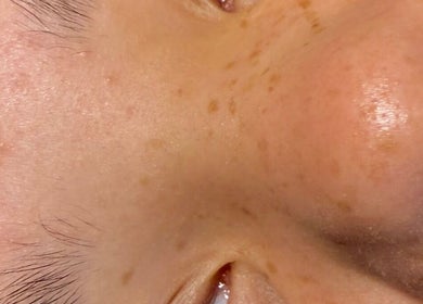 Close-up of a client's radiant skin after treatment at Lash Lift Lounge, East Peckham, England, GB.