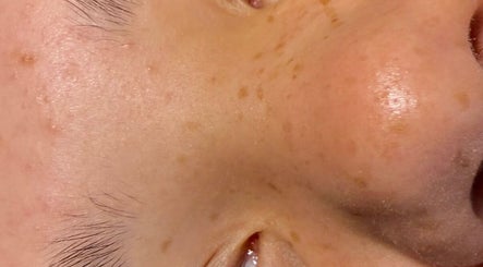 Close-up of a client's radiant skin after treatment at Lash Lift Lounge, East Peckham, England, GB.
