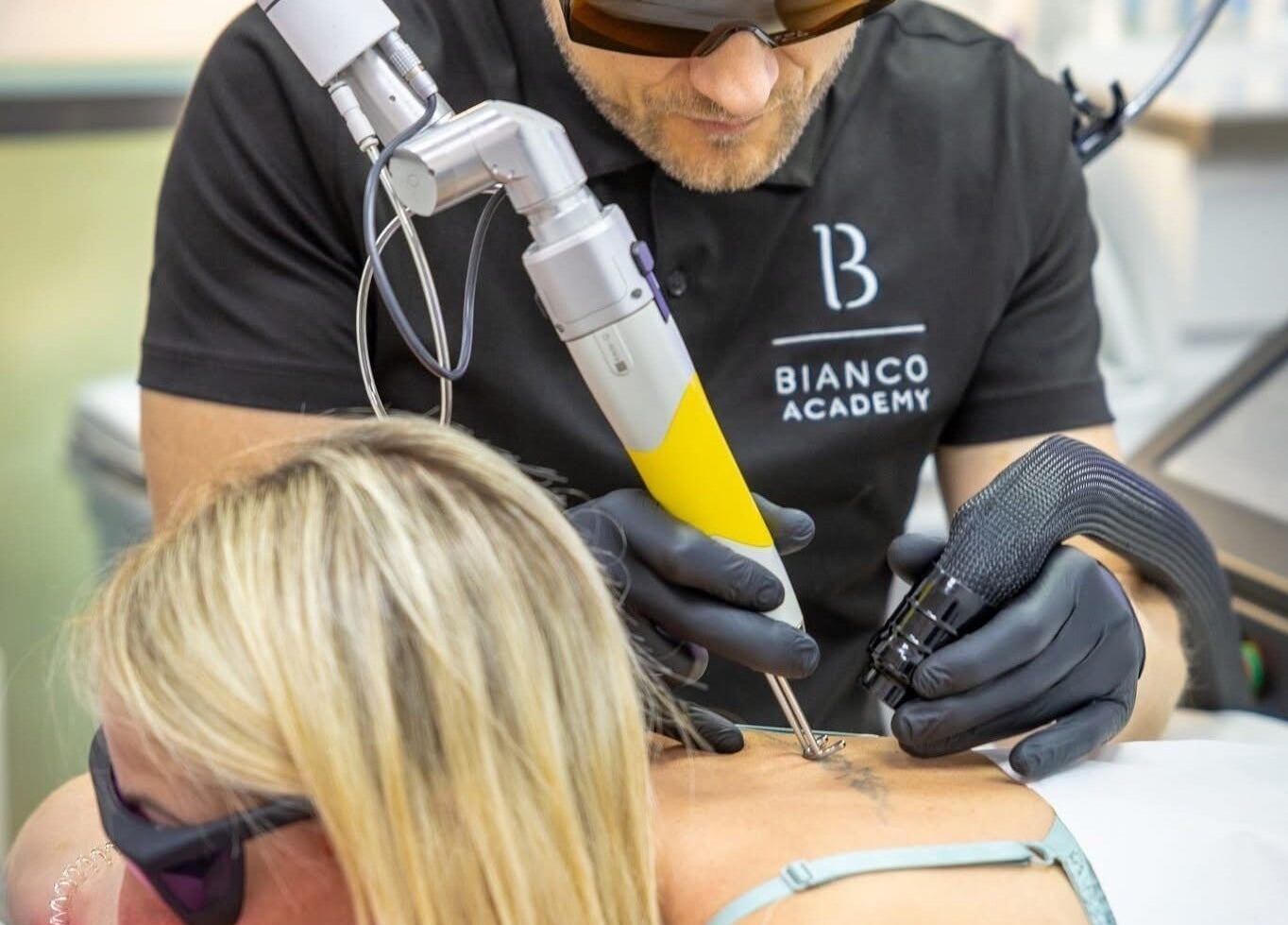Laserowe usuwanie tatuażu w Bianco Beauty Sopot, Sopot, Województwo Pomorskie, PL.