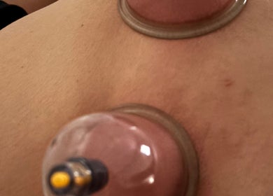Terapia com ventosas na pele em Layla Alves - Estética, São Paulo, São Paulo, BR.