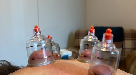 Cupping therapy session at LP Sports Therapy in Burbage, England, GB enhances relaxation and wellness.