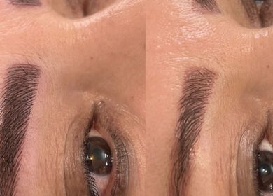 Detailed view of brow transformation at Afraclinic, Vancouver, British Columbia, CA showcasing enhanced beauty.