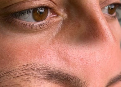 Close-up of a person's eyes capturing natural beauty at Afraclinic in Vancouver, British Columbia, CA.