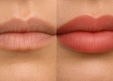 Before and after lip enhancement at LuxeLine Aesthetics, Woodford Green, England, GB.