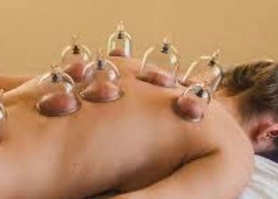 Cupping therapy at Prairie Place RMT, Vermilion, Alberta, CA, enhancing wellness with natural methods.