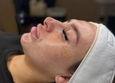 A relaxing facial treatment at Juicy Details Skin Clinic, Manchester, England, GB. Close-up of serene client.
