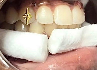 Close-up of tooth with gold star jewel at Kawaii Luxe Glow, Modesto, California, US.