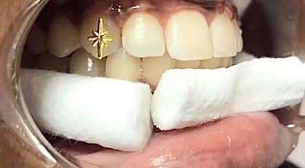 Close-up of tooth with gold star jewel at Kawaii Luxe Glow, Modesto, California, US.