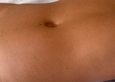 Smooth abdomen prepared for wellness therapy at Vive Contour, Bexleyheath, England, GB.