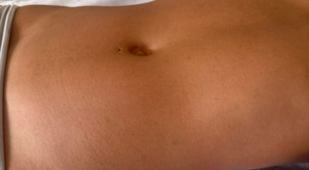 Smooth abdomen prepared for wellness therapy at Vive Contour, Bexleyheath, England, GB.