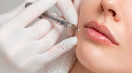 Lip filler treatment at Life Holistics in North Shields, England, GB.