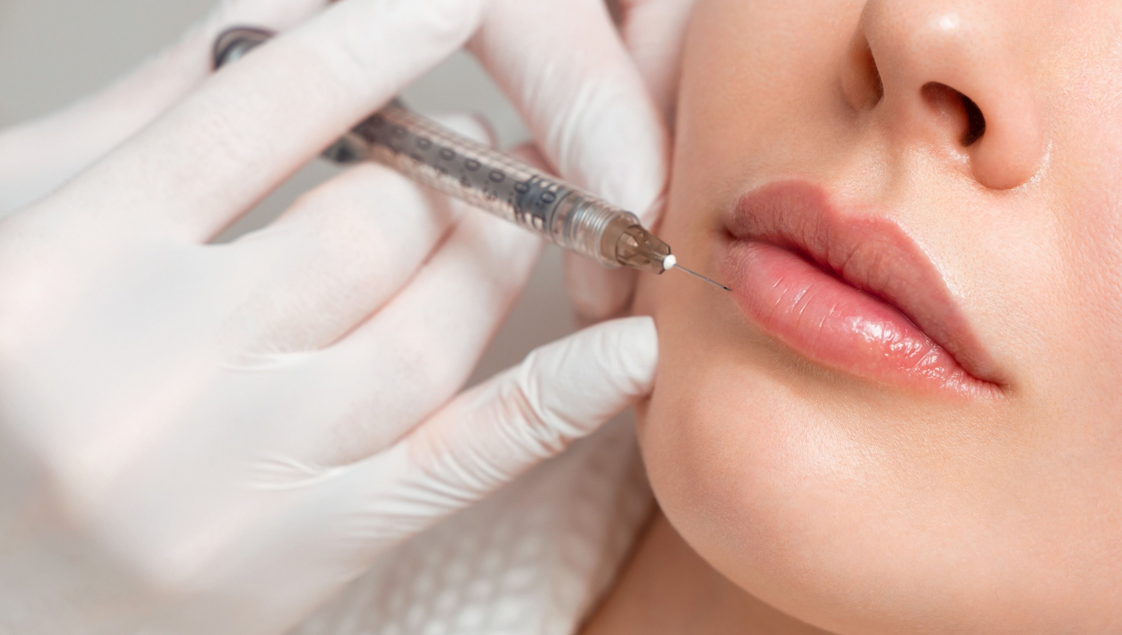 Lip enhancement procedure at Life Holistics, North Shields, England, GB.