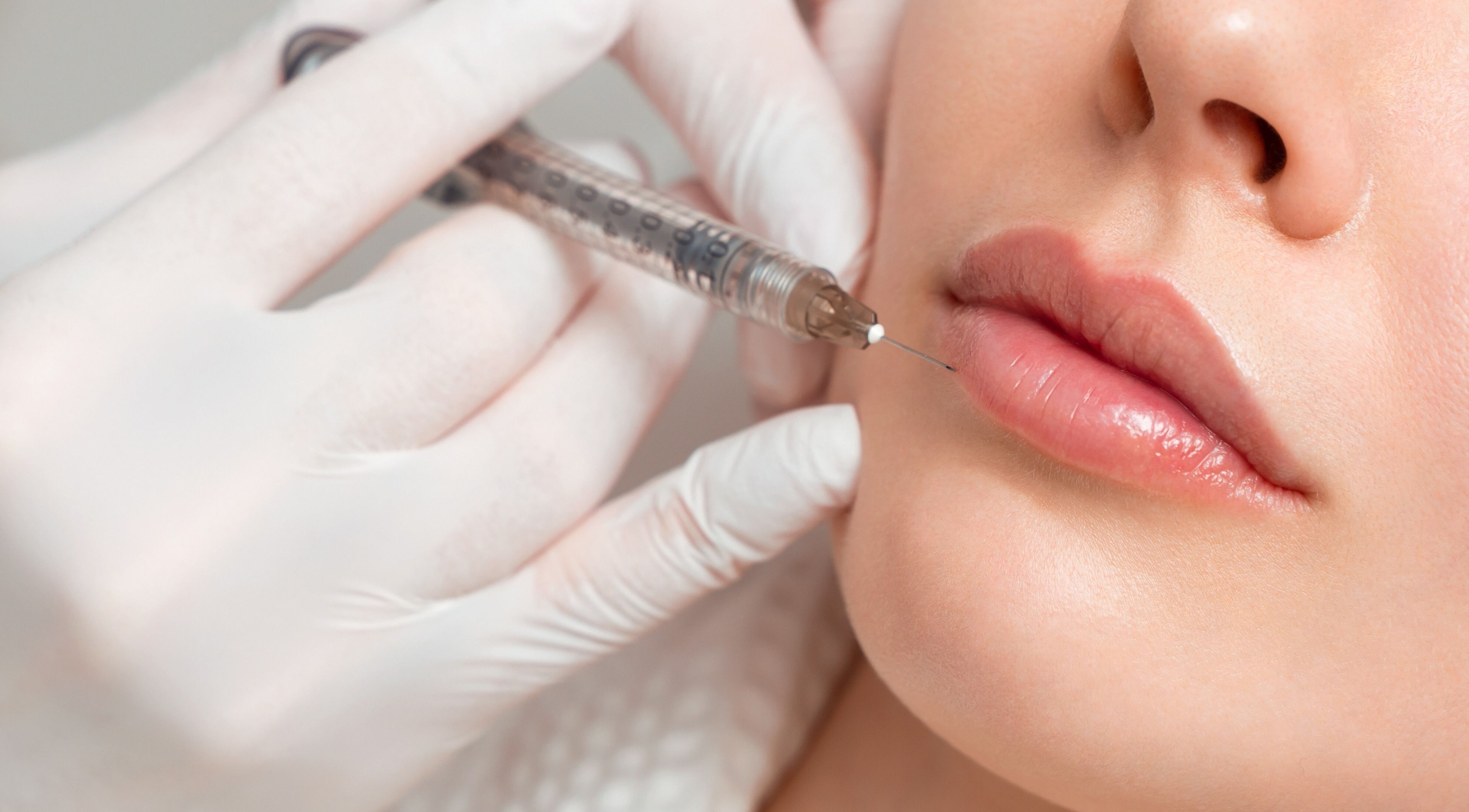 Lip enhancement procedure at Life Holistics, North Shields, England, GB.