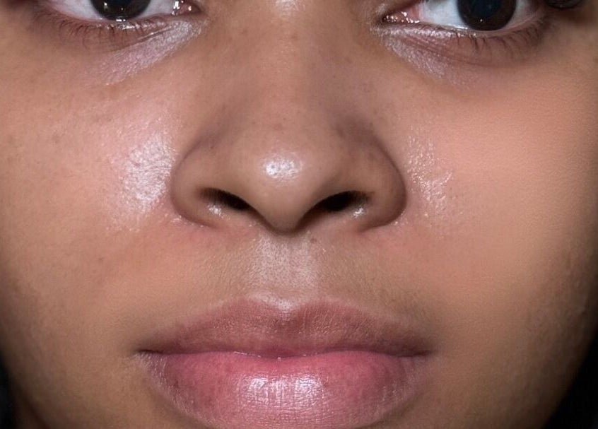 Close-up of glowing skin at Reign Lash and Brow, Georgetown, Demerara-mahaica, GY.