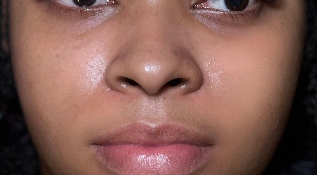 Close-up of glowing skin at Reign Lash and Brow, Georgetown, Demerara-mahaica, GY.