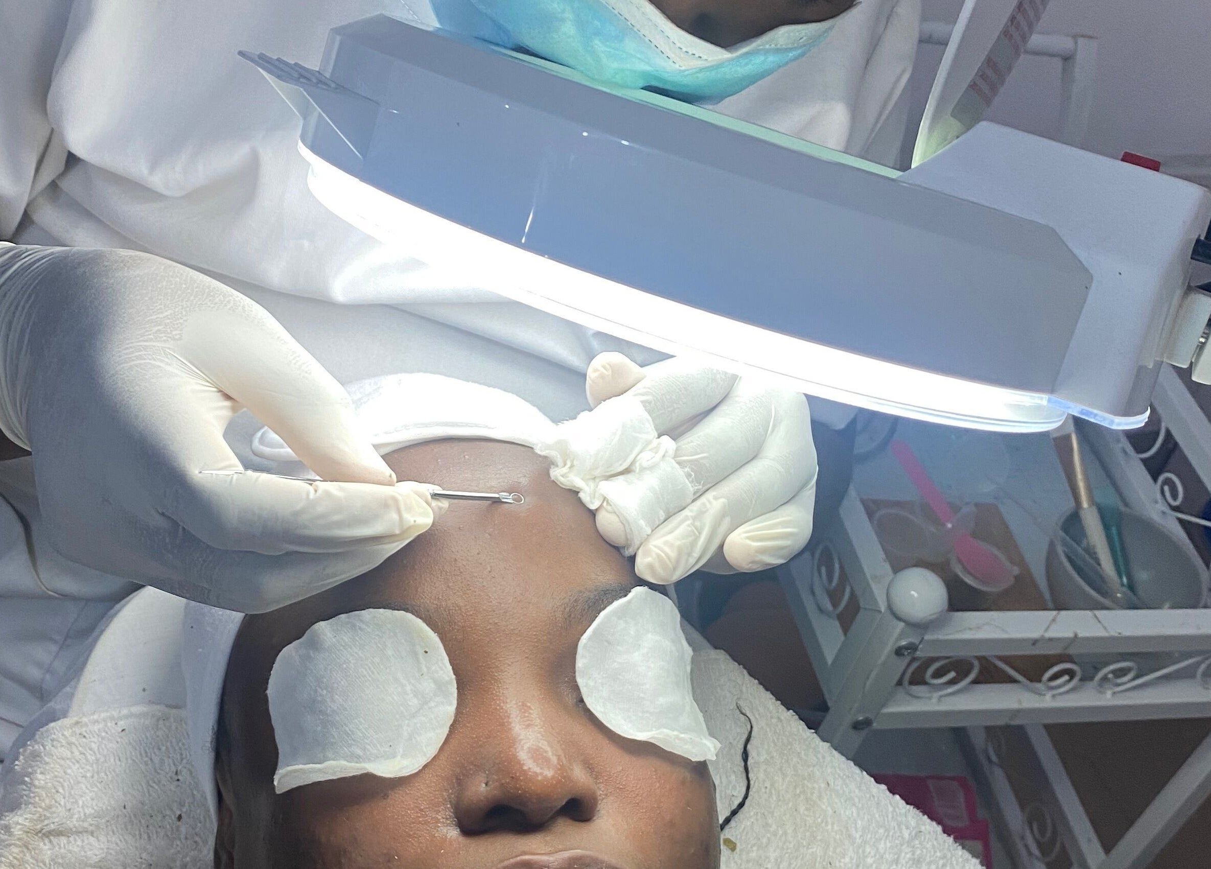 Facial extraction at Frais Esthetics Skincare spa, Lagos, Lagos, NG, showcasing professional skincare treatment.