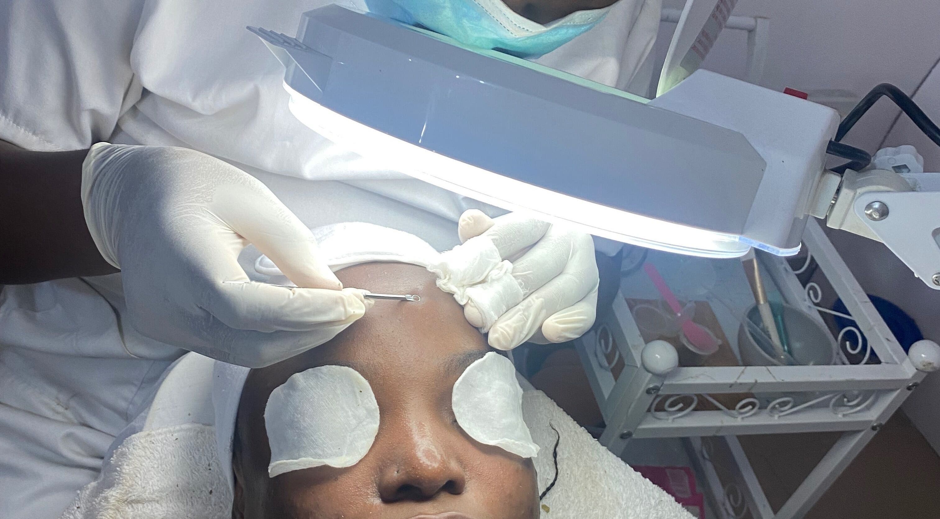 Facial extraction at Frais Esthetics Skincare spa, Lagos, Lagos, NG, showcasing professional skincare treatment.