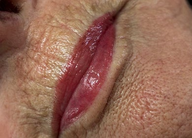 Enhanced lips after treatment at JSSemiPermanantMakeUpByJodie, Sturry, England, GB, showcasing expert artistry.