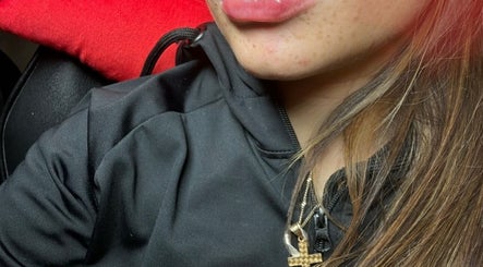 Close-up of glossy lips at RA Aesthetics, Leyland, England, GB, showcasing professional skincare services.