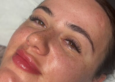 Close-up of a woman's radiant skin post-treatment at Dolluxe Beauty, Aberdeen, Scotland, GB.