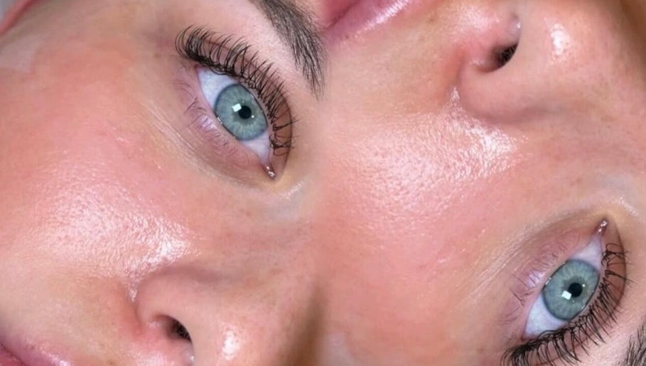 Close-up of glowing skin after treatment at Siennarubybeauty, Westerham, England, GB, highlighting clear complexion.