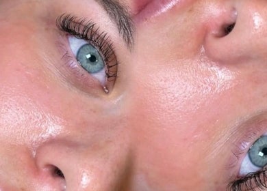 Close-up of glowing skin after treatment at Siennarubybeauty, Westerham, England, GB, highlighting clear complexion.