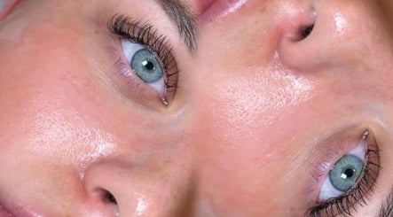 Close-up of glowing skin after treatment at Siennarubybeauty, Westerham, England, GB, highlighting clear complexion.