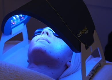 Skin treatment with LED therapy at Alma Aesthetics, Brighton And Hove, England, GB.