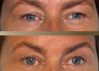 Before and after eye treatment at Soluna, Par, England, GB, showcasing noticeable lash enhancement.
