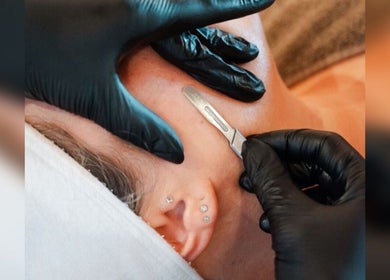 Expert dermaplaning at Athena Miami Head Spa, LLC, Miami, Florida, US, enhancing skin radiance.