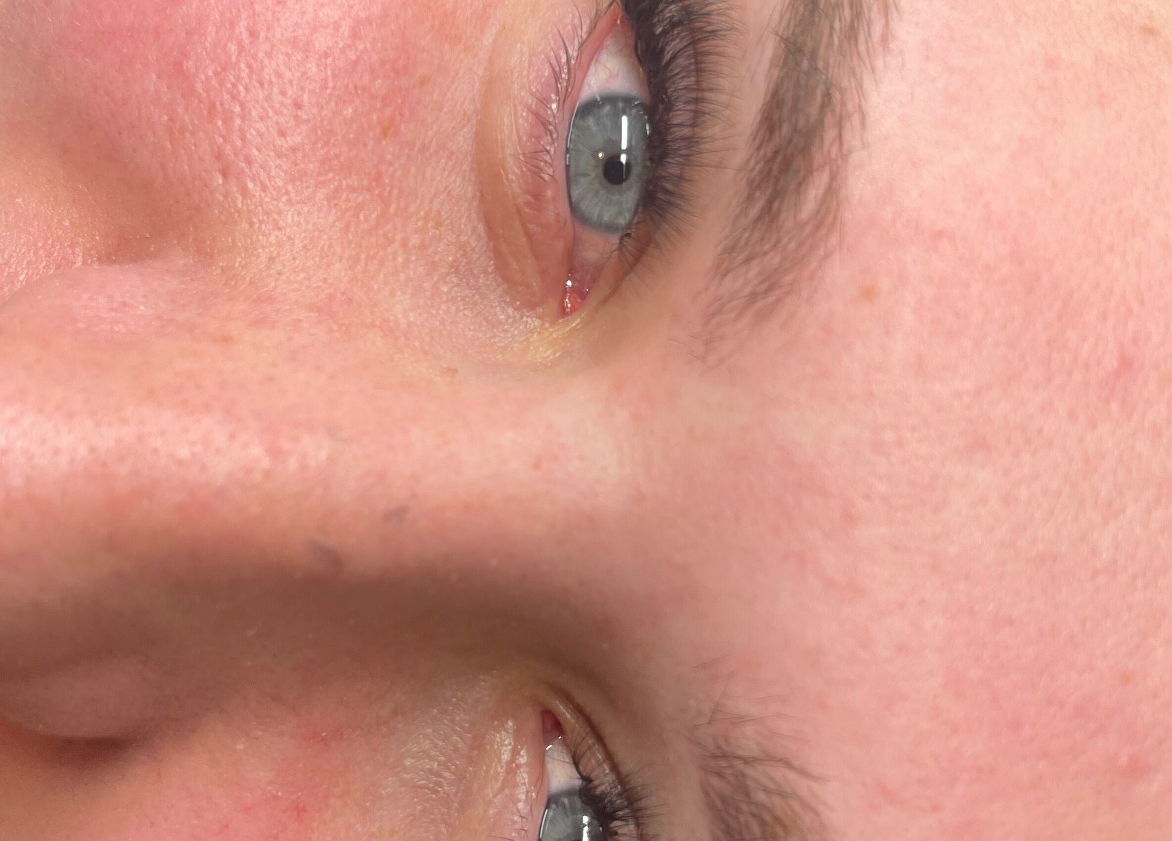 Close-up of healthy skin at Beautybyjmn, Holmview, Queensland, AU, showcasing rejuvenating treatment results.