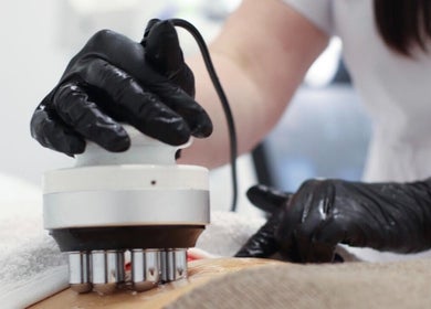 Advanced skin treatment at ND Skin Clinic in Prestwich, England, GB, highlighting modern skincare technology.