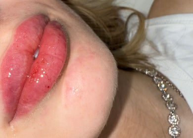 Close-up of glossy lips showcasing beauty care at Bynedsx, Romford, England, GB.