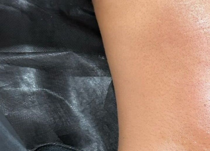 Bodyaidbham spa treatment showcasing smooth skin in Birmingham, England, GB.