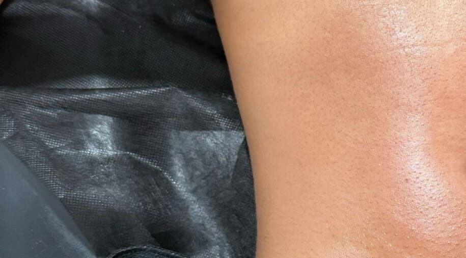 Bodyaidbham spa treatment showcasing smooth skin in Birmingham, England, GB.