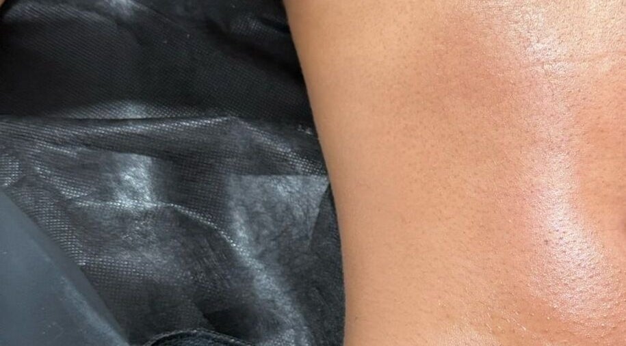 Bodyaidbham spa treatment showcasing smooth skin in Birmingham, England, GB.