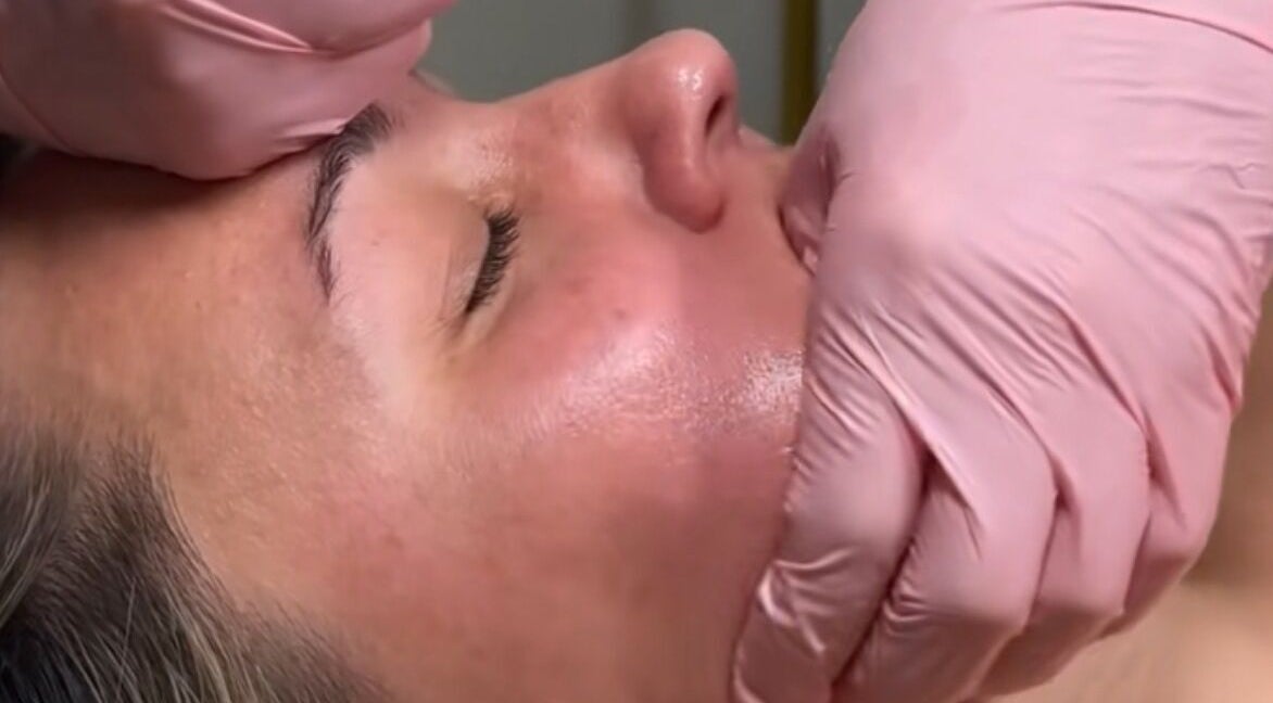 Zabieg liftingu twarzy w Lekkość, Kraków, Województwo Małopolskie, PL, dla promiennej skóry.