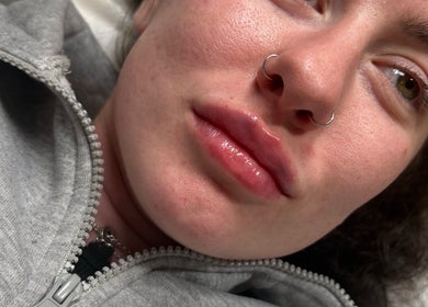 Close-up of glossy lips at R.C Aesthetics, Dublin, County Dublin, IE, showcasing skincare results.