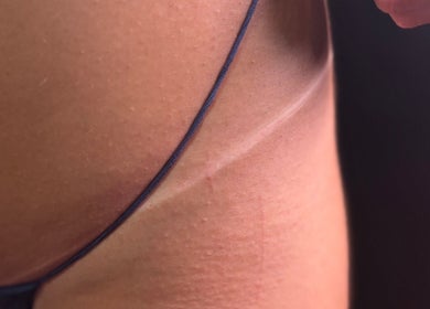 Close-up of smooth skin. Nessknowsglow, Mossley, Ontario, CA offers radiant skin treatments.