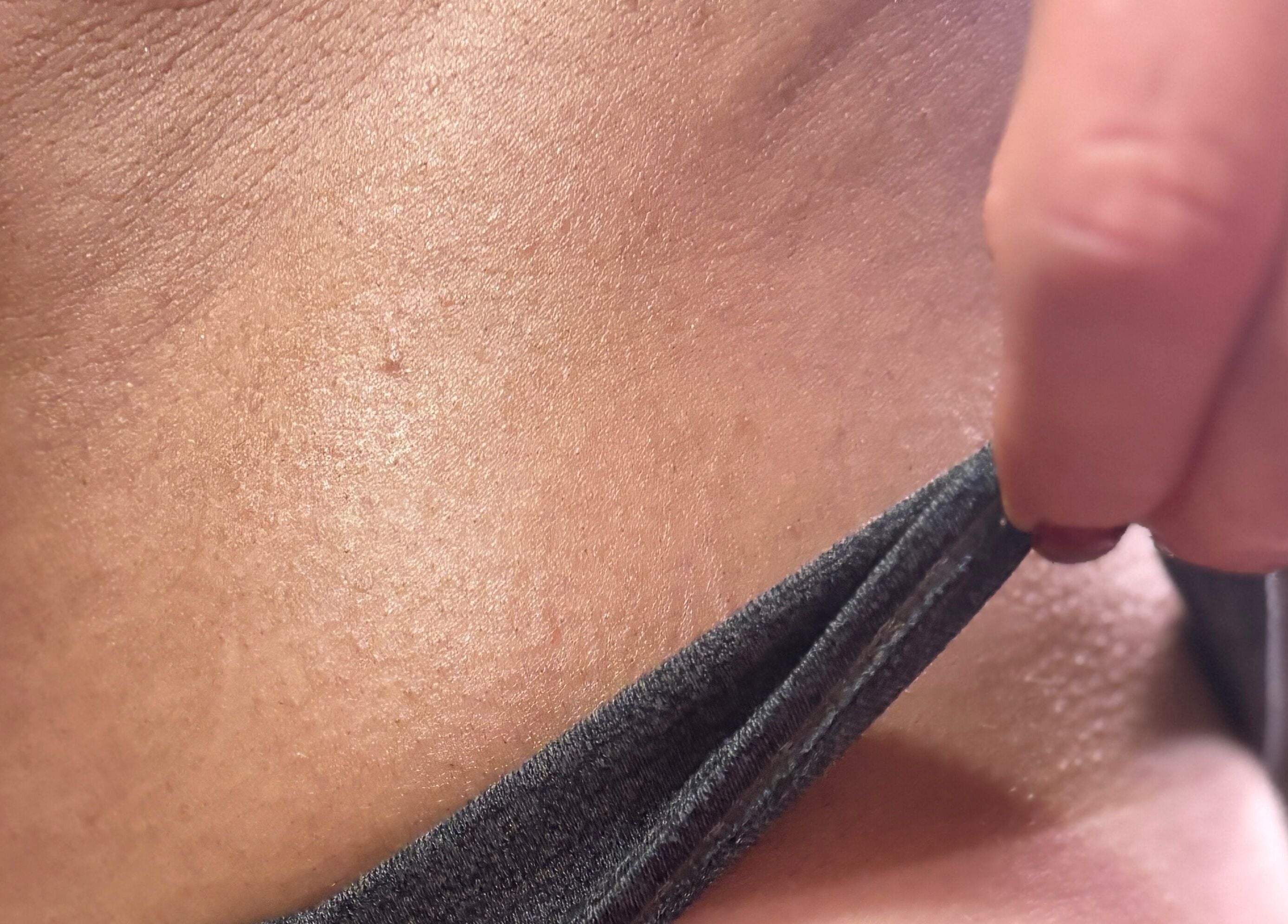 Close-up of radiant skin treatment at Nessknowsglow, Mossley, Ontario, CA.