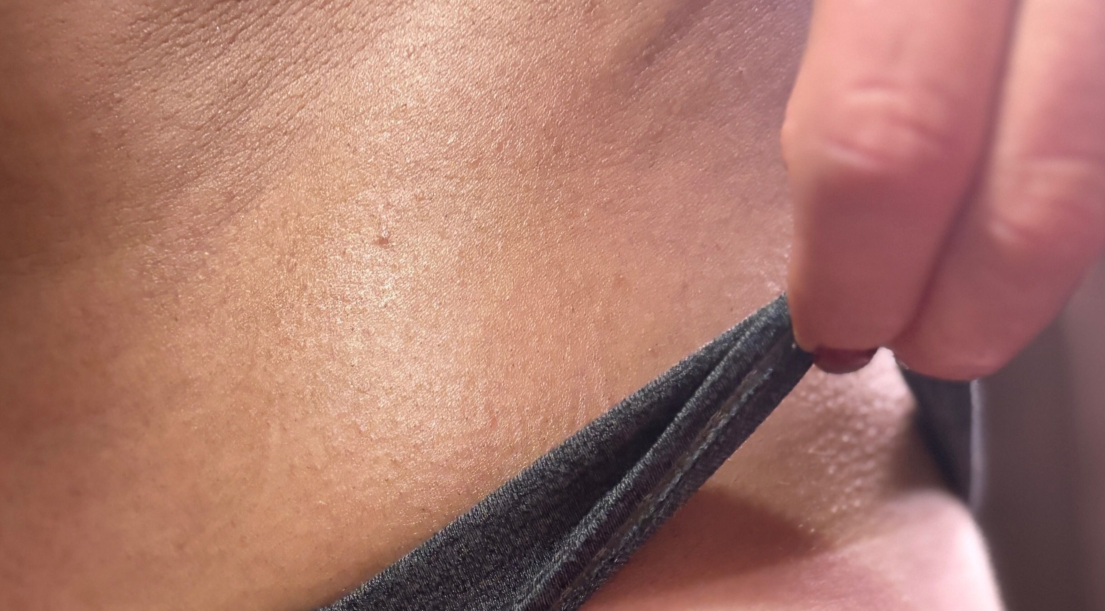 Close-up of radiant skin treatment at Nessknowsglow, Mossley, Ontario, CA.