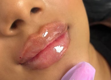 Close-up of glossy lips treated at The Plump Project, Shirley, England, GB, showcasing expert beauty enhancement.