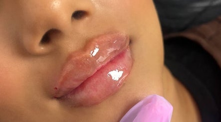 Close-up of glossy lips treated at The Plump Project, Shirley, England, GB, showcasing expert beauty enhancement.