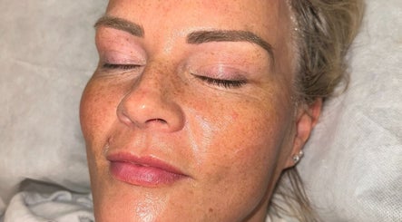 Glowing skin facial treatment at Skn By Leah Jean, Barrhead, Scotland, GB.