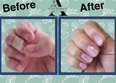 Before and after nail treatment at A Scent of Beauty, Woodcroft, South Australia, AU, showcasing improved nails.