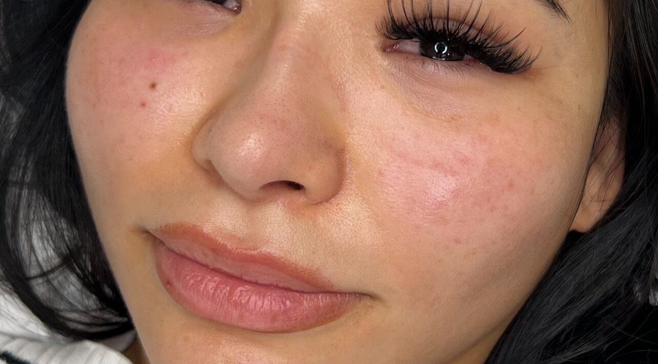 Close-up of a client's fresh complexion at Beauty by Alba in Enfield, England, GB, showcasing upscale skincare.