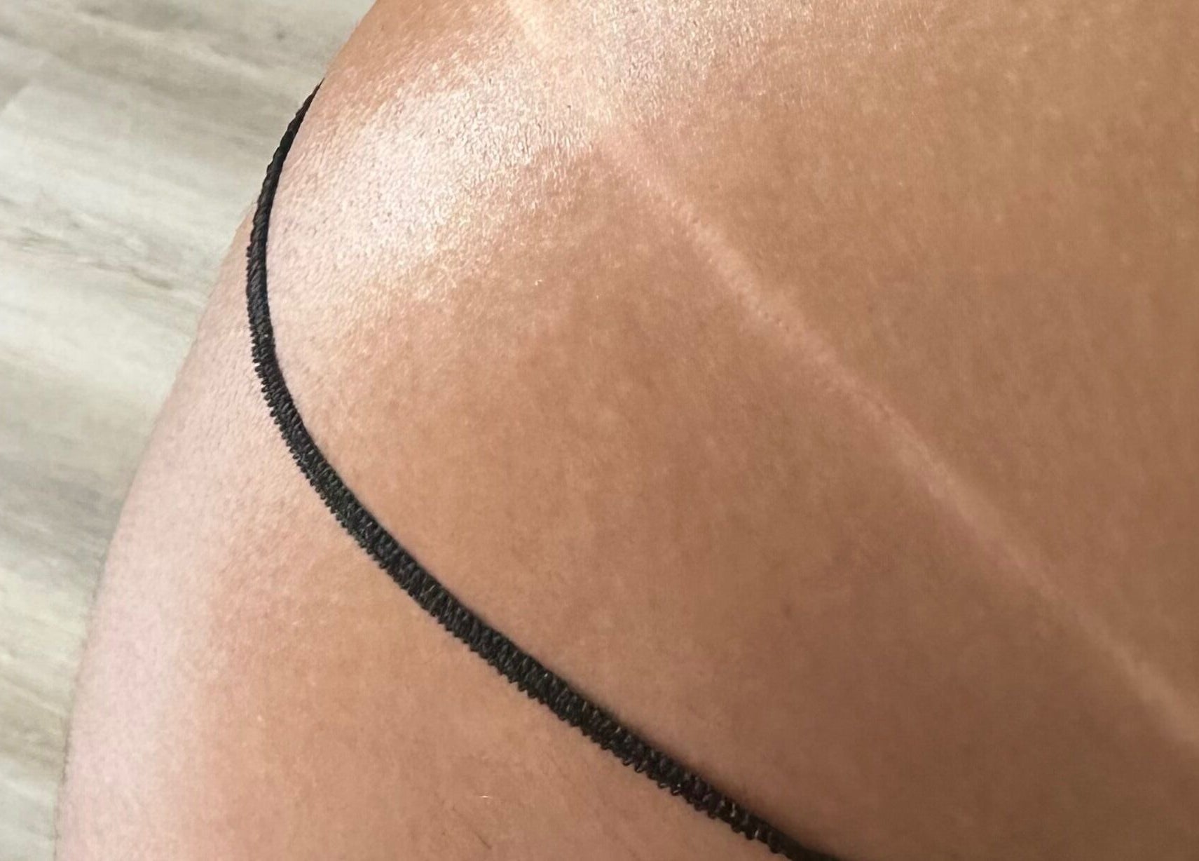 Close-up of a sun-kissed tan from Sprayedbyizz, Narre Warren South, Victoria, AU.