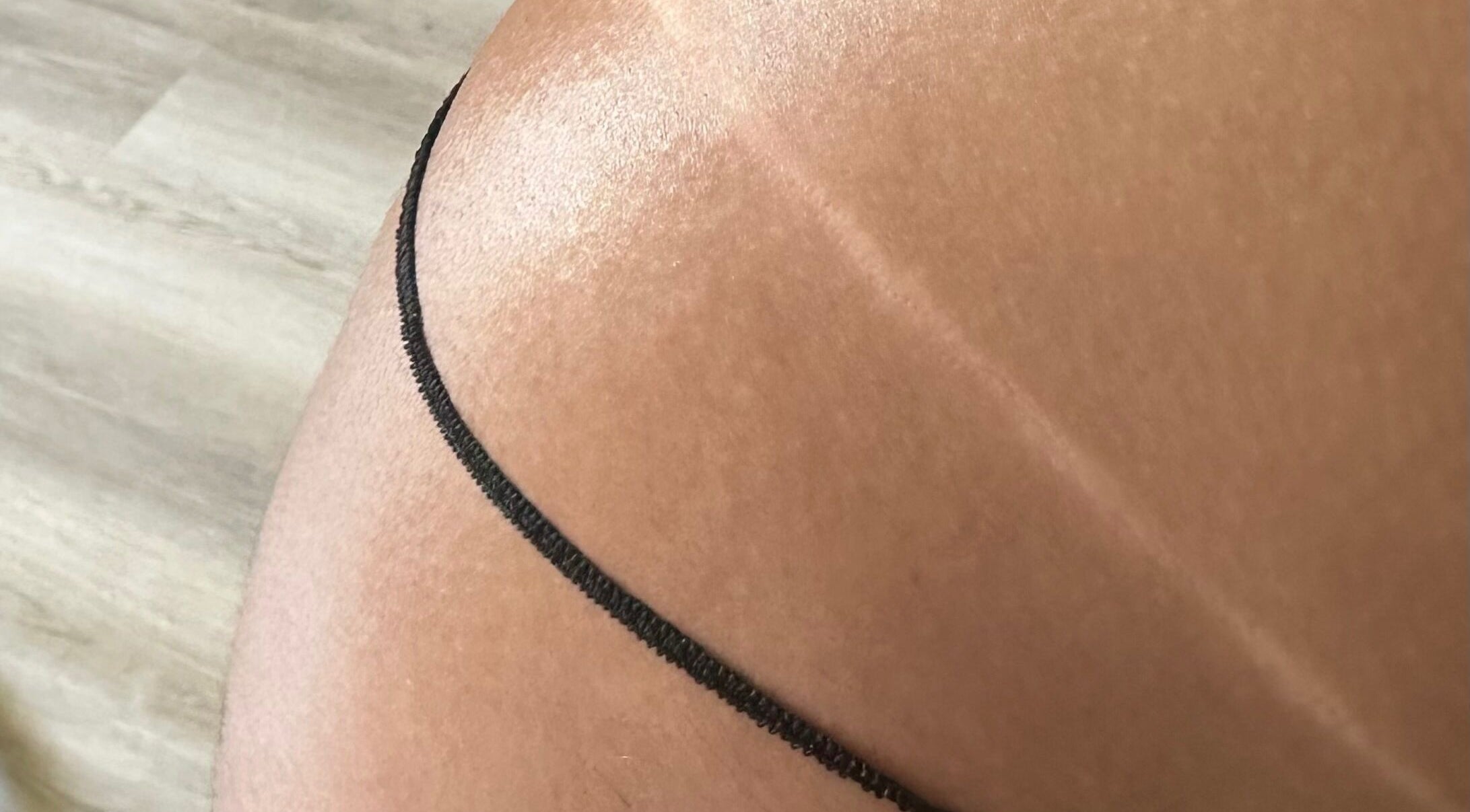 Close-up of a sun-kissed tan from Sprayedbyizz, Narre Warren South, Victoria, AU.