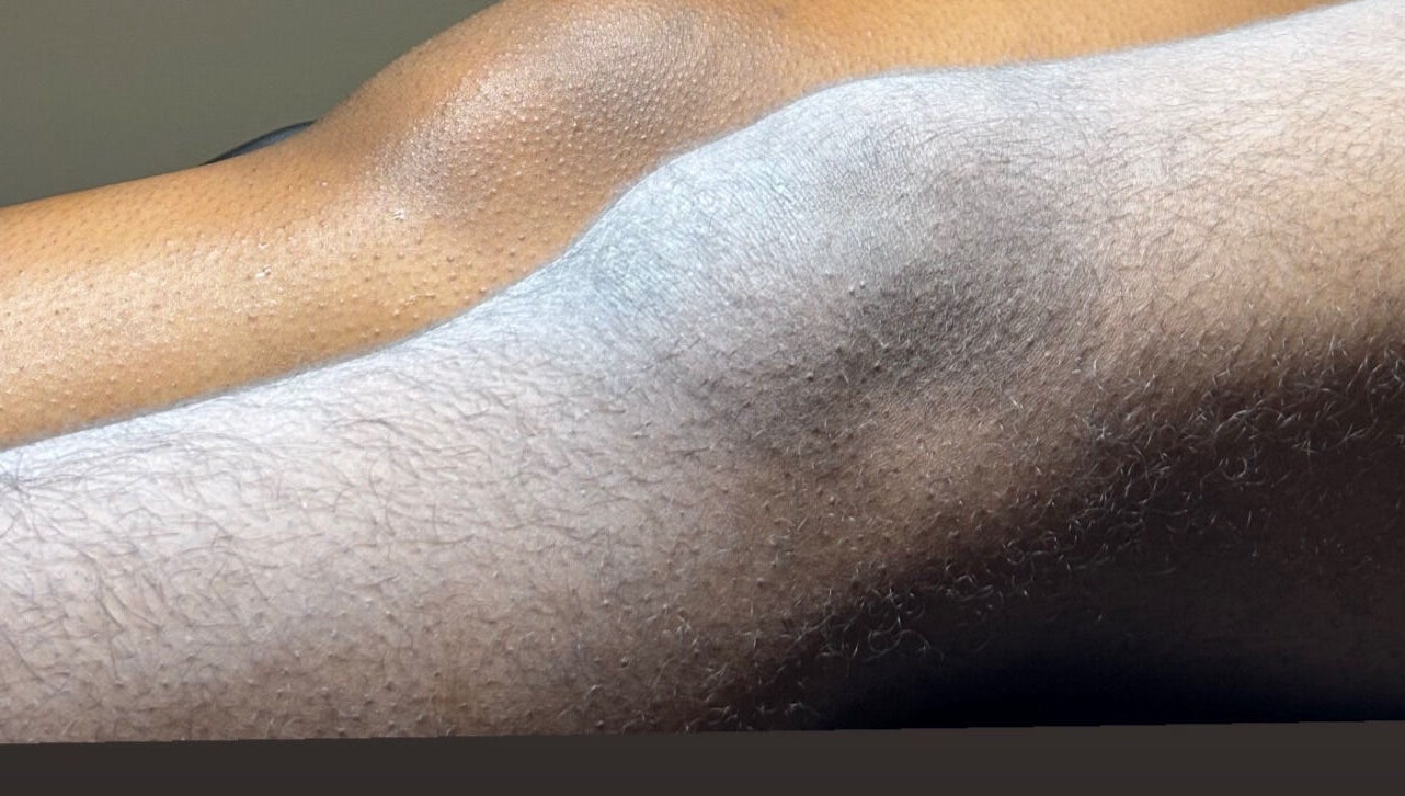 Smooth skin after sugaring at The Sugaring Salon in Willemstad, CW. Experience silky skin today.